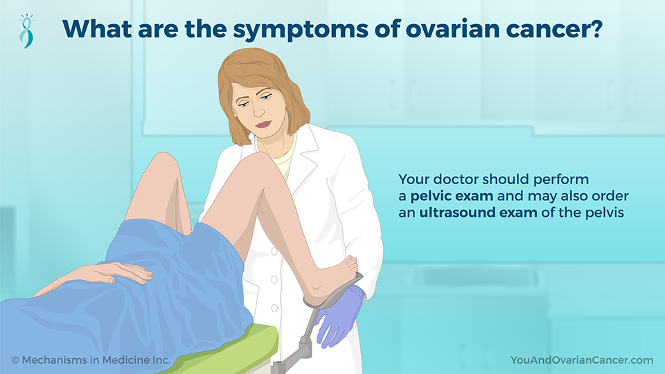 What are the symptoms of ovarian cancer?